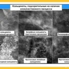 Многопрофильная клиника Союз на улице Матросская Тишина Фотография 13